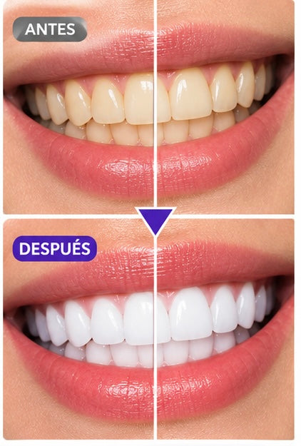 Espuma Blanqueadora Dental V34 – HVIQAN